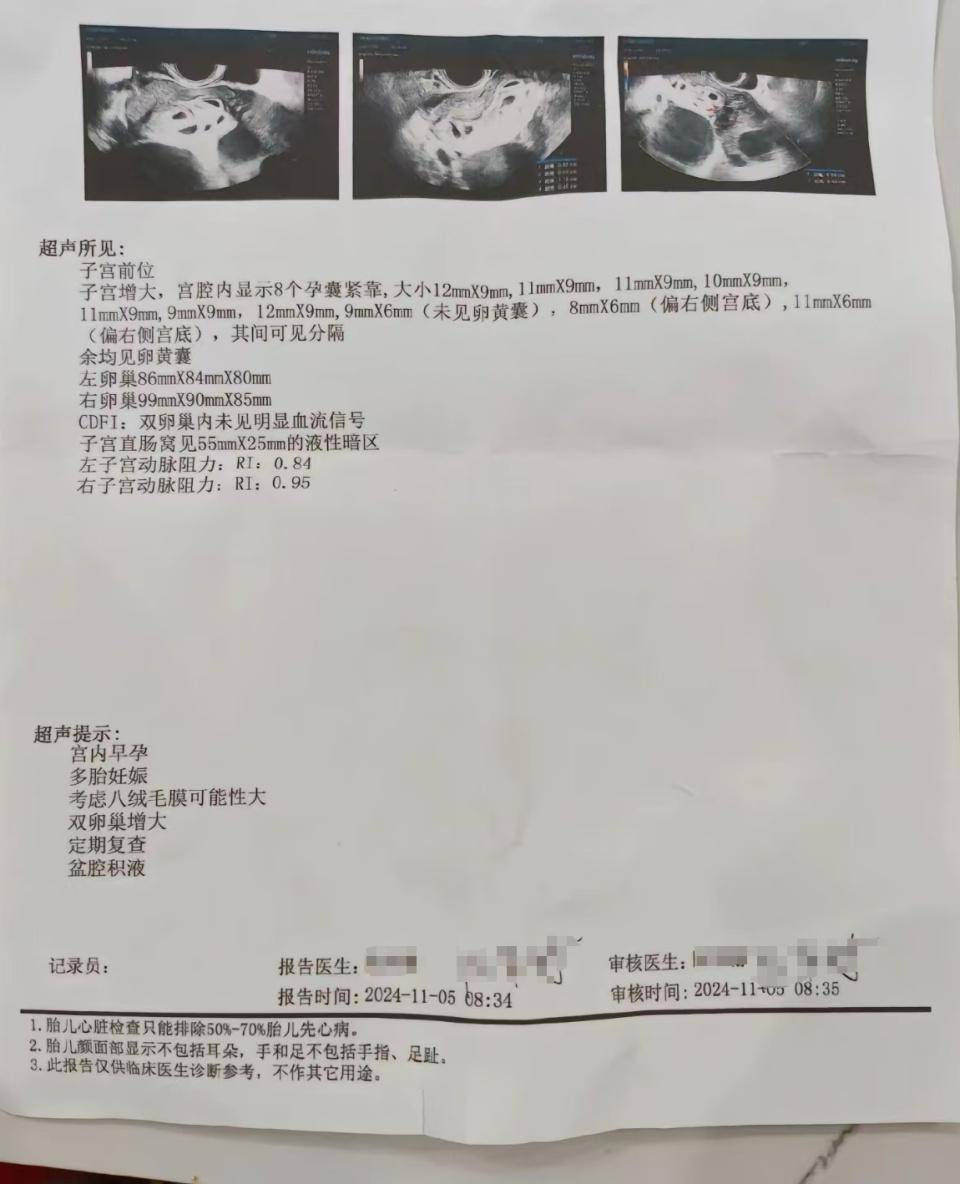 怀上9胞胎女子今日进行减胎手术：分两次进行<strong></p>
<p>币安币商</strong>，第一次减去四个胚胎，第二次减去三个