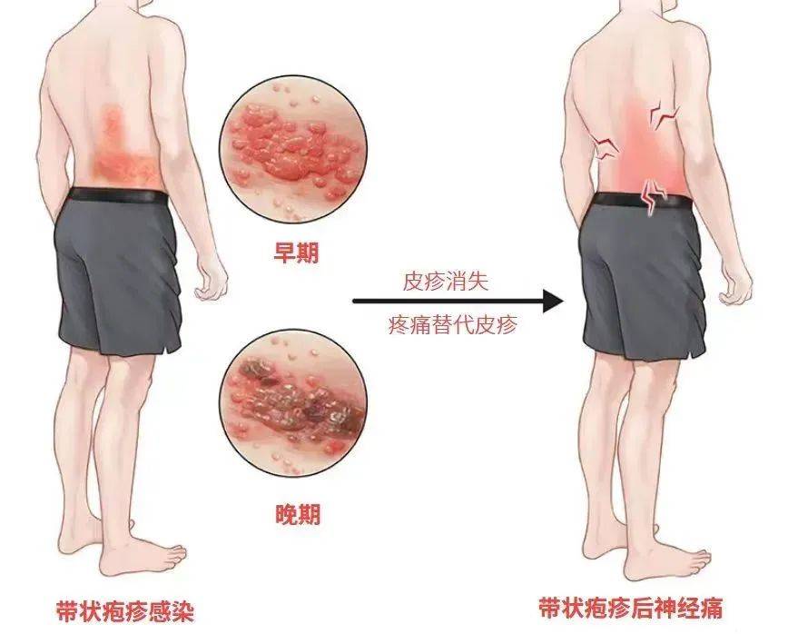 一旦感染终身携带<strong></p>
<p>币安币商</strong>！深圳疾控提醒：这4类人要注意