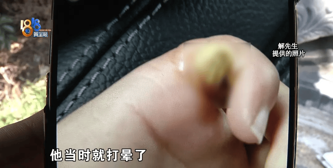 5岁男童瞬间晕厥<strong></p>
<p>币安合约</strong>，筋都断了！街上常见，看见立即远离