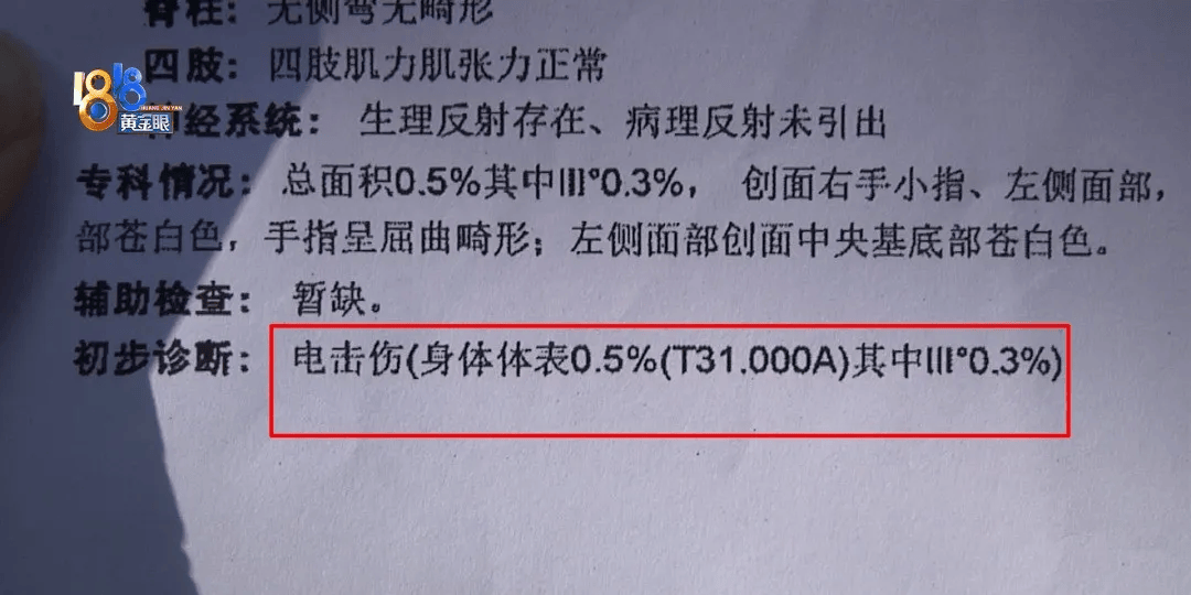5岁男童瞬间晕厥<strong></p>
<p>币安合约</strong>，筋都断了！街上常见，看见立即远离