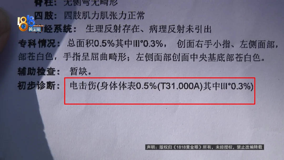 5岁男童瞬间晕厥<strong></p>
<p>币安合约</strong>，筋都断了！街头常见，看见立即远离！