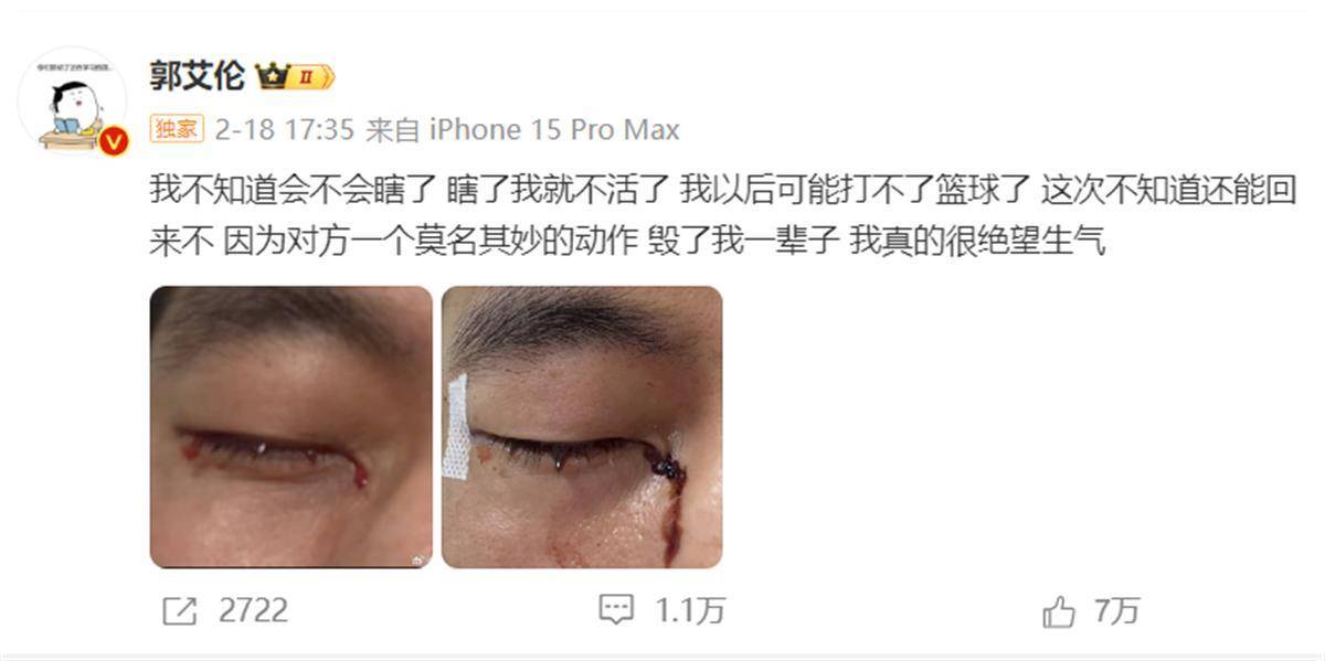 郭艾伦发文报平安：已顺利拆线<strong></p>
<p>币安网址</strong>，相信一定会重回球场