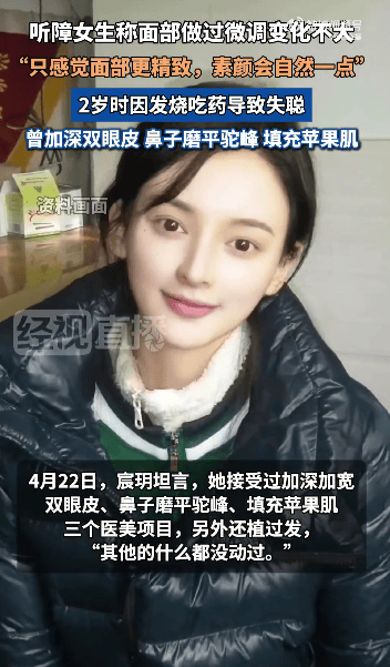“美院聋哑女生因长相太完美”登热搜第一<strong></p>
<p>币安宝钱包</strong>，本人承认微调：不太上镜，比照片视频好看