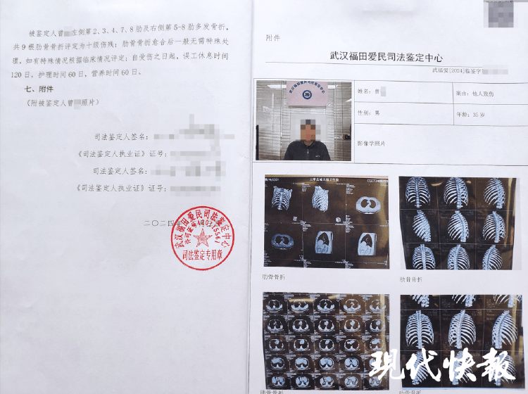 湖北一男子称被交警打断9根肋骨未立案<strong></p>
<p>币安交易所商家</strong>，警方回应