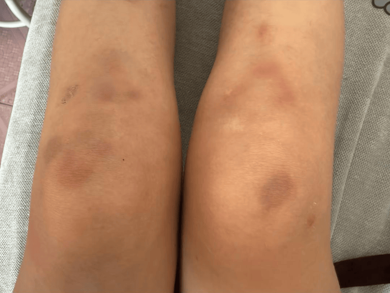 女子自称因工资问题被老板锁办公室里打 警方：双方已到派出所<strong></p>
<p>抹茶交易所</strong>，是否打人还在调查