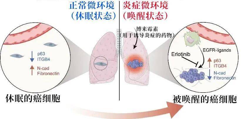 长期炎症会“唤醒”癌细胞<strong></p>
<p>越南抹茶交易所</strong>！这份抗炎指南每个人都该看看