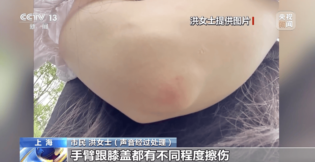 央视曝光:共享单车骑行中自动锁车<strong></p>
<p>海外版下载链接</strong>,致多人受伤!北京、广东等多地都发生类似情况,原因查明