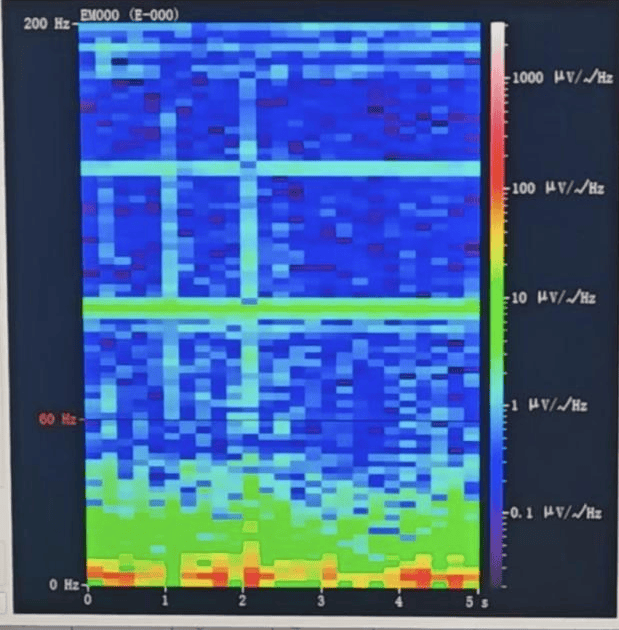山西首例<strong></p>
<p>中国中铁股票</strong>!山西省人民医院成功实施脑机接口辅助功能区脑肿瘤切除手术