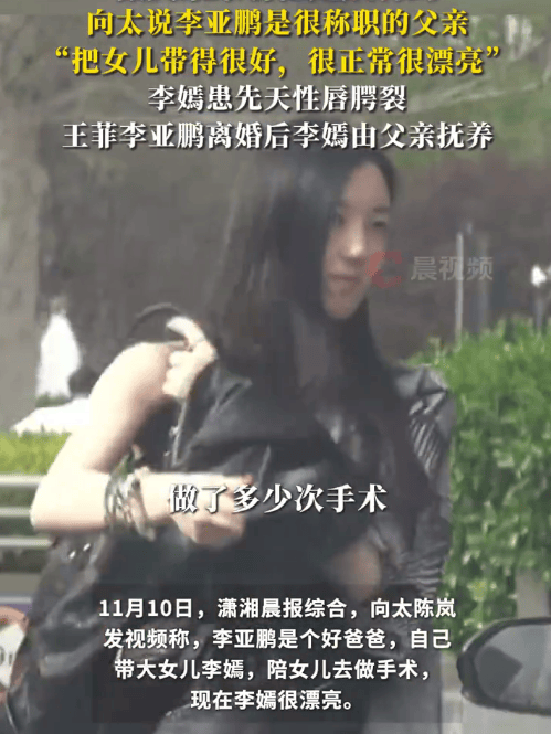 向太说李亚鹏是个好爸爸:<strong></p>
<p>海天味业股票</strong>他自己带大女儿李嫣还陪她做手术