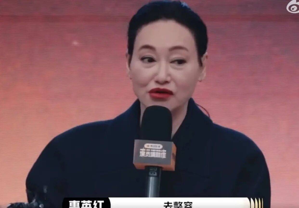 考古|惠英红自曝拿奖后谈百倍涨薪!拍打戏至残疾阑尾手术后7天复工<strong></p>
<p>山东黄金股票</strong>,她的人生是拼出来的