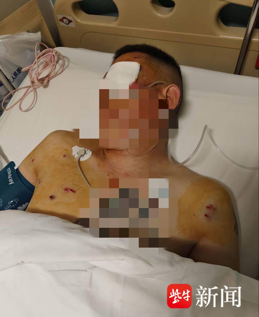 紫牛头条｜男子取款170万在银行门口遭抢劫致重伤，当事人认为银行保安未帮忙应担责